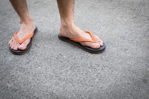 夏天千萬別「穿這種鞋子」出門！醫嚴厲警告 特別是這5種人...太胖的人上榜