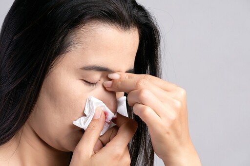 天氣熱更易流鼻血「2原因」曝！鼻腔黏膜變得更薄了 醫授2招預防