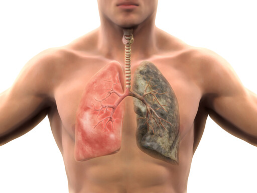 肺癌發病、死亡率都最高！醫列「肺部7症狀」真的怪怪的 與這1類人同住罹癌率激增