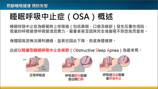 睡眠障礙與失智症風險有關！醫師推1檢測揪出共病