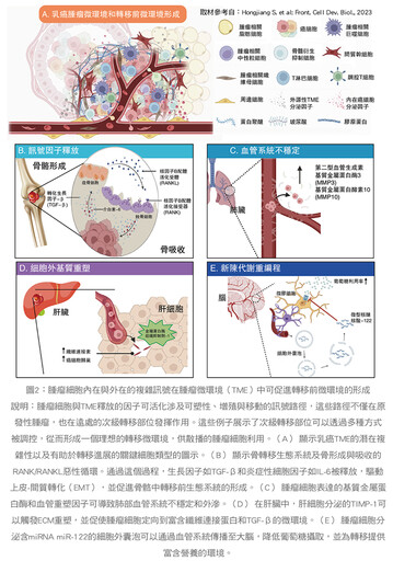 張金堅：變調的交響曲：乳癌轉移揭秘