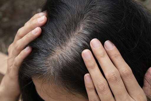 頭髮愈染愈細還掉光？醫揭「5大傷害」超多人不知道 一年最好別超過這次數