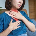 不是感冒！聲音突然變沙啞可能是過敏害的 醫授「5招」快速緩解