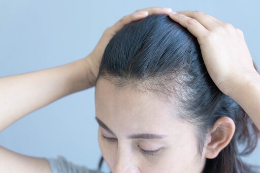 每天洗頭都掉一堆頭髮？醫曝「5元兇」讓你髮量愈來愈稀 更年期也中招