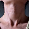 28歲女健檢驚見甲狀腺結節 一查竟是最常見甲狀腺癌！