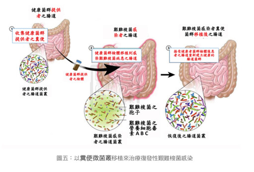 張金堅、潘子明：腸道菌群平衡，身體健康 研究：常喝咖啡，腸道好菌增