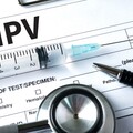 抹片＋HPV檢測新政策上路，25歲起女性免費篩檢，男生也納入疫苗補助！