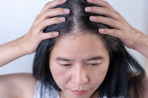 你的壽命長不長？醫揭「頭髮5線索」自測 過早長白髮恐是心臟在求救