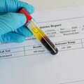 吃得清淡仍高膽固醇？ 醫列「10大錯誤觀念」：奶油蛋糕比滷肉飯還可怕