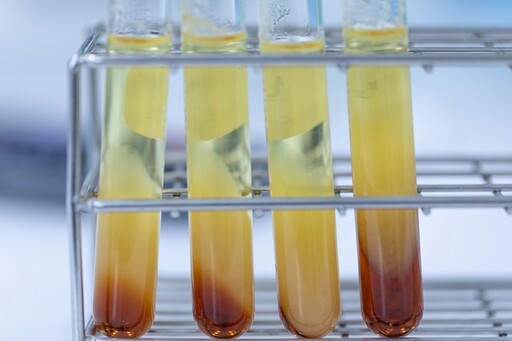 「三酸甘油脂vs膽固醇」差在哪？專家用1比喻秒懂 教你對症調整飲食降血脂