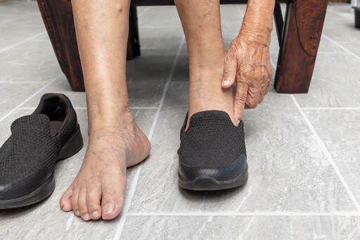 腳痠、膝痛、腰背也在痛？醫曝「穿錯鞋」是元兇 挑鞋記得4大關鍵