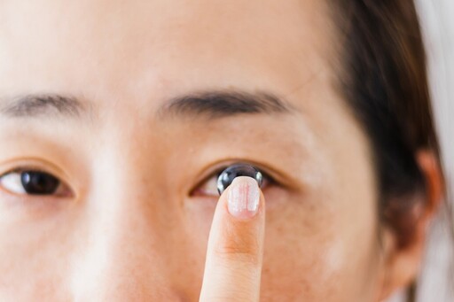 成人能戴角膜塑型片嗎？ 眼科醫曝「4大好處」：乾眼症、3C族都受益