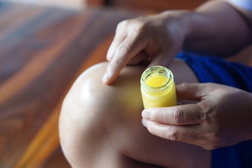 外用類固醇藥膏「這樣用」恐誘發糖尿病！藥師示警 擦多不會更快好