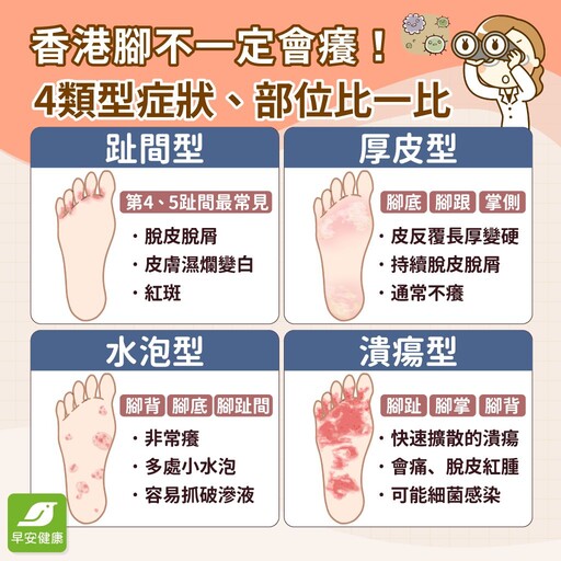 香港腳症狀會自己好嗎？會傳染到手和臉嗎？香港腳藥膏推薦怎麼擦？真正治療香港腳水泡脫皮方法
