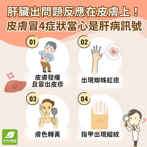 她皮膚癢以為過敏，再拖恐肝硬化！小心4種皮膚症狀是肝臟有問題