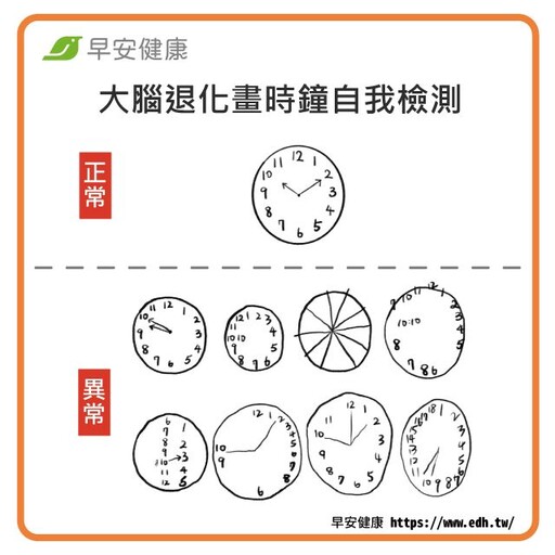 拿出紙筆畫時鐘！大腦退化3招自我檢測，這動作撐不到20秒警惕失智風險