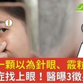 眼睛長一顆以為針眼、霰粒腫，竟是癌症找上眼！醫曝3徵兆分辨