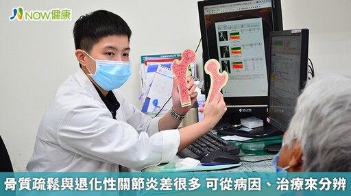 骨質疏鬆與退化性關節炎差很多 可從病因、治療來分辨