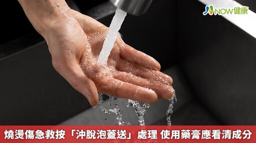 燒燙傷急救按「沖脫泡蓋送」處理 使用藥膏應看清成分