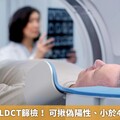 AI精確判讀LDCT篩檢！ 可揪偽陽性、小於4mm肺結節