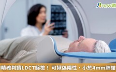 AI精確判讀LDCT篩檢！ 可揪偽陽性、小於4mm肺結節