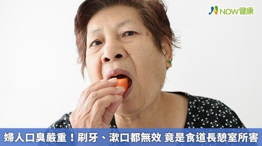 婦人口臭嚴重！刷牙、漱口都無效 竟是食道長憩室所害