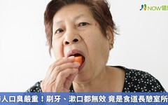 婦人口臭嚴重！刷牙、漱口都無效 竟是食道長憩室所害