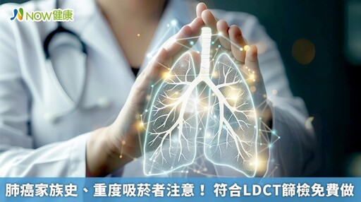 肺癌家族史、重度吸菸者注意！ 符合LDCT篩檢免費做