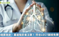 肺癌家族史、重度吸菸者注意！ 符合LDCT篩檢免費做