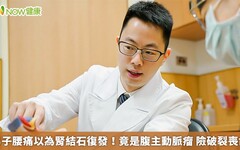 男子腰痛以為腎結石復發！竟是腹主動脈瘤 險破裂喪命