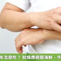 乾癬患者秋冬怎麼吃？ 秋燥應避開海鮮、牛羊肉、辣椒