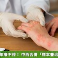 老翁濕疹多年癢不停！ 中西合併「標本兼治」化解危肌