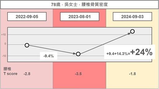 亞東醫院整合AI檢測骨質疏鬆！ 提供骨鬆患者全面照顧