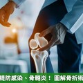 骨折手術要提防感染、骨髓炎！ 圖解骨折術後照護重點