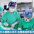 乳癌婦因淋巴水腫難以穿衣 自體遠端移植手術改善症狀