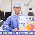 甲狀腺長結節是罹癌嗎？ 醫：甲狀腺結節近9成是良性