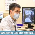 72歲老翁腰痛解尿困難 送醫發現患病機率僅百萬分之1