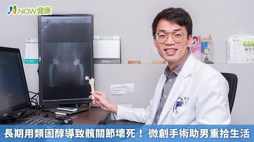 長期用類固醇導致髖關節壞死！ 微創手術助男重拾生活