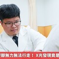 60歲男突雙腳無力無法行走！ X光發現竟是腫瘤找上門