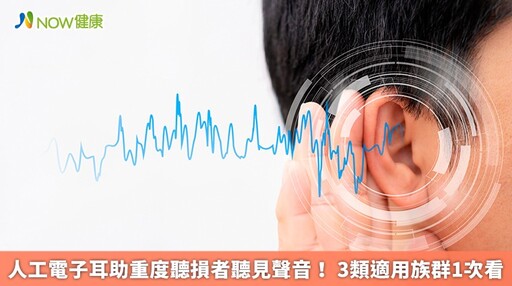 人工電子耳助重度聽損者聽見聲音！ 3類適用族群1次看