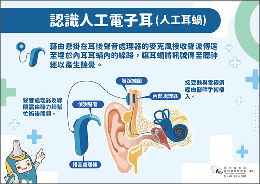 人工電子耳助重度聽損者聽見聲音！ 3類適用族群1次看