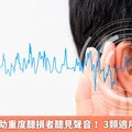 人工電子耳助重度聽損者聽見聲音！ 3類適用族群1次看