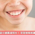 因牙齦增生從小被霸凌到大！ 牙冠增長術讓女子獲新生