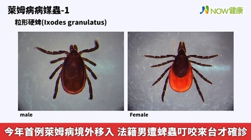 今年首例萊姆病境外移入 法籍男遭蜱蟲叮咬來台才確診