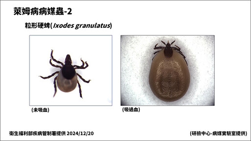 今年首例萊姆病境外移入 法籍男遭蜱蟲叮咬來台才確診