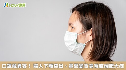 口罩藏異容！ 婦人下顎突出、鼻翼變寬竟罹肢端肥大症