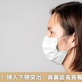 口罩藏異容！ 婦人下顎突出、鼻翼變寬竟罹肢端肥大症