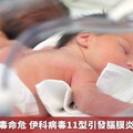 嬰兒染腸病毒命危 伊科病毒11型引發腦膜炎併血栓重症