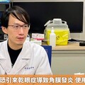 愛種假睫毛恐引來乾眼症導致角膜發炎 使用1物助改善