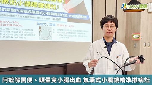 阿嬤解黑便、頭暈竟小腸出血 氣囊式小腸鏡精準揪病灶